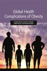 Book cover of Global Health Complications of Obesity by Jahangir Moini