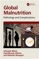 Book cover of Global Malnutrition by Unknown