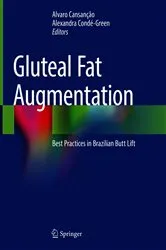 Book cover of Gluteal Fat Augmentation by Alvaro Cansanção