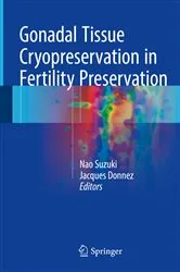 Book cover of Gonadal Tissue Cryopreservation in Fertility Preservation by Nao Suzuki