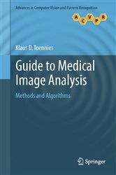Book cover of Guide to Medical Image Analysis by Klaus D. Toennies