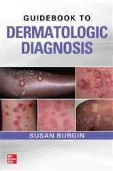 Book cover of Guidebook to Dermatologic Diagnosis by Susan Burgin