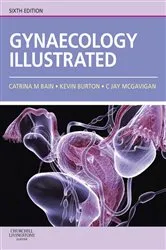 Book cover of Gynaecology Illustrated E-Book (6th ed.) by Bain MBChB, MRCOG, Catrina