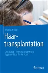 Book cover of Haartransplantation by Frank G. Neidel