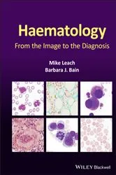 Book cover of Haematology by Mike Leach