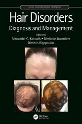 Book cover of Hair Disorders by Alexander C. Katoulis