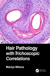 Book cover of Hair Pathology with Trichoscopic Correlations by Mariya Miteva
