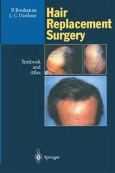 Book cover of Hair Replacement Surgery by Pierre Bouhanna
