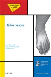 Book cover of Hallux valgus by Barbara Piclet-Legré