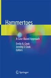 Book cover of Hammertoes by Emily A. Cook