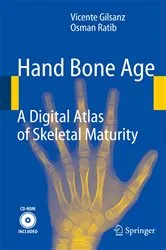 Book cover of Hand Bone Age by Vicente Gilsanz