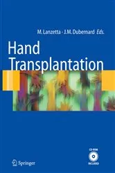 Book cover of Hand transplantation by Palmina Petruzzo