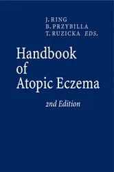 Book cover of Handbook of Atopic Eczema (2nd ed.) by Johannes Ring