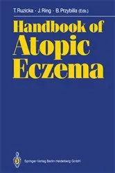 Book cover of Handbook of Atopic Eczema by Thomas Ruzicka