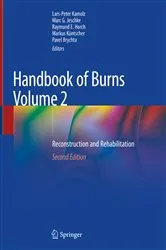 Book cover of Handbook of Burns Volume 2 (2nd ed.) by Lars-Peter Kamolz