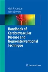 Book cover of Handbook of Cerebrovascular Disease and Neurointerventional Technique by Mark R. Harrigan