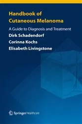 Book cover of Handbook of Cutaneous Melanoma by Dirk Schadendorf