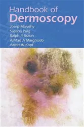 Book cover of Handbook of Dermoscopy by Unknown
