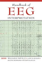 Book cover of Handbook of EEG Interpretation by Selim R. Benbadis