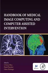 Book cover of Handbook of Medical Image Computing and Computer Assisted Intervention by S. Kevin Zhou