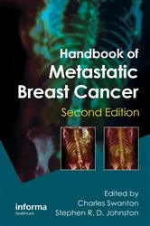 Book cover of Handbook of Metastatic Breast Cancer (2nd ed.) by Charles Swanton