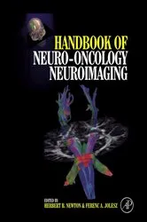 Book cover of Handbook of Neuro-Oncology Neuroimaging by Herbert B. Newton MD in Oncology-Neurosurgery