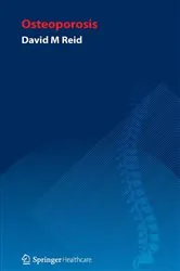 Book cover of Handbook of Osteoporosis by David Reid