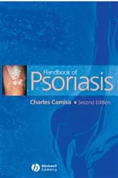 Book cover of Handbook of Psoriasis (2nd ed.) by Charles Camisa