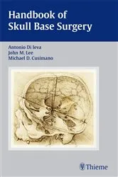 Book cover of Handbook of Skull Base Surgery by Antonio Di Ieva