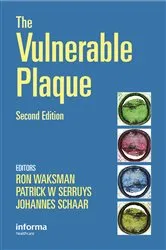 Book cover of Handbook of the Vulnerable Plaque (2nd ed.) by Unknown