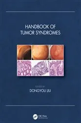 Book cover of Handbook of Tumor Syndromes by Dongyou Liu