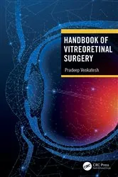 Book cover of Handbook of Vitreoretinal Surgery by Pradeep Venkatesh