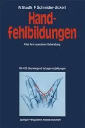 Book cover of Handfehlbildungen by W. Blauth