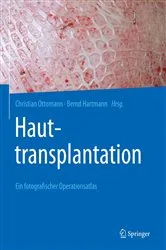 Book cover of Hauttransplantation by Christian Ottomann