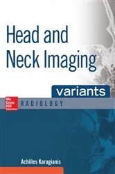 Book cover of Head and Neck Imaging Variants by Achilles Karagianis