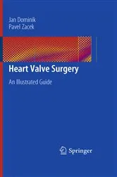 Book cover of Heart Valve Surgery by Jan Dominik
