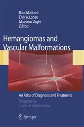 Book cover of Hemangiomas and Vascular Malformations by Raul Mattassi