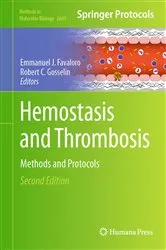 Book cover of Hemostasis and Thrombosis (2nd ed.) by Unknown