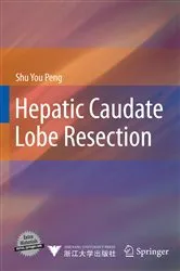 Book cover of Hepatic Caudate Lobe Resection by Shu You Peng