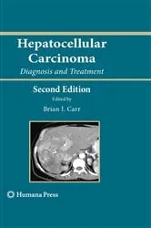 Book cover of Hepatocellular Carcinoma (2nd ed.) by Brian I. Carr