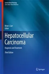 Book cover of Hepatocellular Carcinoma (3rd ed.) by Brian I. Carr