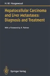 Book cover of Hepatocellular Carcinoma and Liver Metastases: Diagnosis and Treatment by Henri-Marcel Hoogewoud