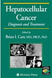Book cover of Hepatocellular Carcinoma by Brian I. Carr