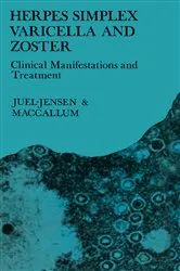 Book cover of Herpes Simplex Varicella and Zoster by B. E. Juel-Jensen
