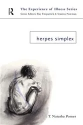 Book cover of Herpes Simplex by T. Natasha Posner