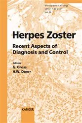 Book cover of Herpes Zoster by G. Gross