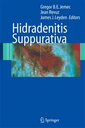 Book cover of Hidradenitis Suppurativa by Unknown