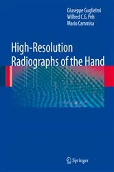 Book cover of High-Resolution Radiographs of the Hand by Giuseppe Guglielmi