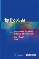 Book cover of Hip Dysplasia by Paul E. Beaulé
