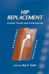 Book cover of Hip Replacement by Raj K. Sinha
